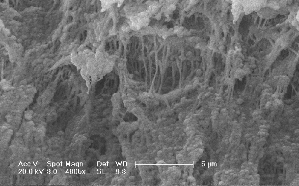 The Micro Structure of PE Separator